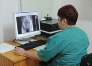 Рентгеновите филми отиват в историята
