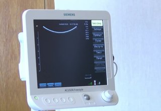 Ултразвуков ехограф от ново поколение получи ботевградската болница Скрийншот