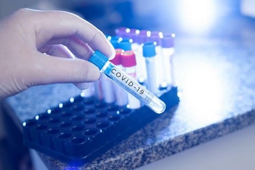 19 новозаразени с COVID-19 в община Ботевград