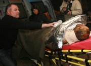 10 тежко ранени след взрив на газова бутилка в Скравена