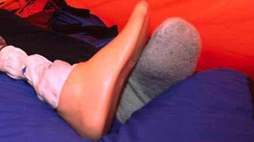 Доктор даде на пациент два леви крака