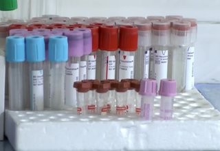 Увеличава се броят на хората, които си правят PCR тестове в лаборатория Ботевград Скрийншот