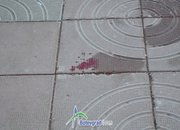 Момче пострада при каскада с велосипед 
