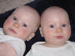 Австралийка съди лекаря си, защото родила близначета