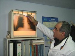 Д-р Милчо Чипев: 5 случая на турбекулоза са регистрирани от началото на годината