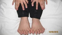 Китайче има общо 31 пръста краката и ръцете