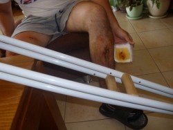 Две момчета от Ботевград са били зверски пребити по погрешка