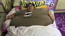 Най-дебелата жена в света не е излизала 25 години от дома си