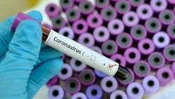 Тест за коронавирус и в ботевградска лаборатория