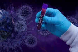 Втори доказан случай на коронавирус в Ботевград