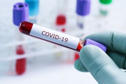 Установени са 6 положителни проби на коронавирус в община Етрополе