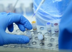 Отрицателни са резултатите от тестовете за коронавирус в двете социални институции в Правец