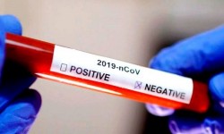 Информация за резултатите от взетите проби за коронавирус  