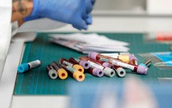 Незаконосъобразно е изискването на PCR тест като условие за прием в болница или консултация със специалист