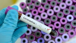 116 са новите случаи на коронавирусна инфекция, потвърдени у нас през изминалите 24 часа
