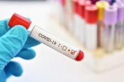 14 нови случаи на коронавирус в община Ботевград