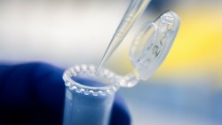 27 новозаразени с COVID-19 в община Ботевград