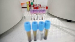8 нови случая на коронавирус в община Ботевград
