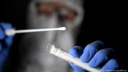 11 новозаразени с COVID-19 в периода 19 - 21 декември в община Ботевград