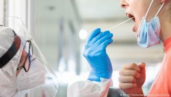 Регистрирани са 17 нови случая на коронавирус в община Ботевград за последните 3 дни