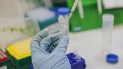 Регистрирани са 9 нови случая на коронавирус в община Ботевград за последните 4 дни