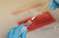73-ма новодиагностицирани с коронавирус в община Ботевград за последните 3 дни