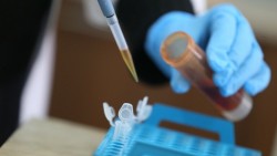 29 новодиагностицирани с коронавирус в община Ботевград за последните 4 дни