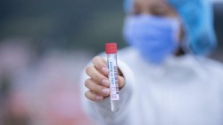 16 новодиагностицирани с коронавирус в община Ботевград за последните 3 дни