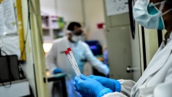 9 новодиагностицирани с коронавирус в община Ботевград за последните 24 часа