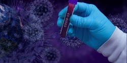 11 новодиагностицирани с коронавирус в община Ботевград за последните 3 дни