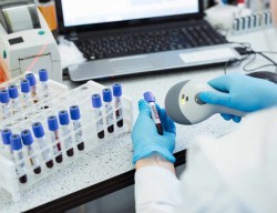 Изследване на T-клетъчен имунитет срещу SARS-COV-2 в МБАЛ-Ботевград