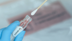 Регистрирани са 10 нови случая на коронавирус в община Ботевград за последните 3 дни