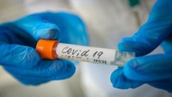 21 новозаразени с коронавирус вчера