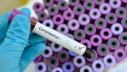 19 ботевградчани са заразените с КОВИД-19 вчера