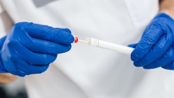 Агенция по лекарствата: 11 антигенни теста могат да се прилагат в училище  