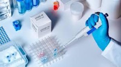 Положителните резултати от изследване за антитела не се считат за достатъчни за издаването на сертификат за преболедуване