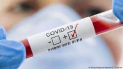 71 нови случая на коронавирус за последните два дни в община Ботевград
