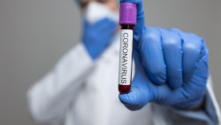 Само за един ден са регистрирани 40 нови случая на коронавирус в община Ботевград
