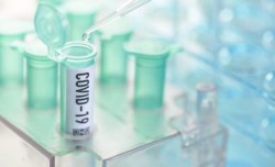 19 случая на коронавирусна инфекция в периода 3-5 декември