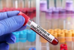 74 нови случая на коронавирус са регистрирани в Община Ботевград за последните 5 дни
