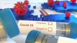 Ботевград и Етрополе в топ 3 с най-много положителни проби за COVID-19 от софийска област