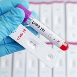 84 потвърдени нови случаи на коронавирус в община Ботевград